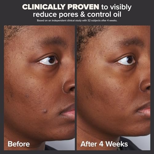 Paulas Choice-SKIN PERFECTING 2% BHA Liquid Salicylic Acid Exfoliant-Facial Exfoliant for Blackheads, Enlarged Pores, Wrinkles & Fine Lines, 4 oz Bottle Paula's Choice: Beauty & Personal Care - Image 3