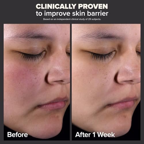 Paulas Choice-SKIN PERFECTING 2% BHA Liquid Salicylic Acid Exfoliant-Facial Exfoliant for Blackheads, Enlarged Pores, Wrinkles & Fine Lines, 4 oz Bottle Paula's Choice: Beauty & Personal Care - Image 2
