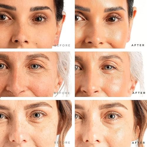 Tree of Life Facial Skin Care Set, Brightening, Firming, Hydrating, Dry Face, Dermatologist Tested - Trio Power Kit, Vitamin C, Retinol and Hyaluronic Acid, 3 count of 1 Fl Oz Beauty & Personal Care - Image 3