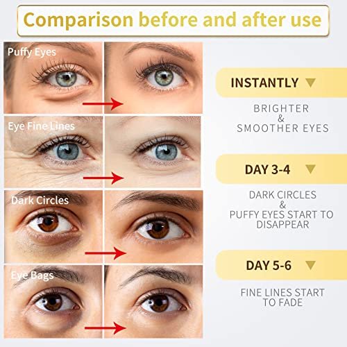NAZANO Under Eye Patches - 60 Pcs - 24K Gold Eye Mask- Puffy Eyes & Dark Circles Treatments,Reduce Under Eye Bags and Smooth Wrinkles,Eye Skin Care Pads With Collagen,Hyaluronic Acid & Castor Oil Everything Else - Image 3